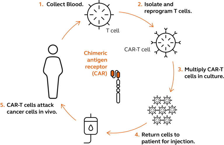 Fig 1: Car T Therapeutic Pathway
